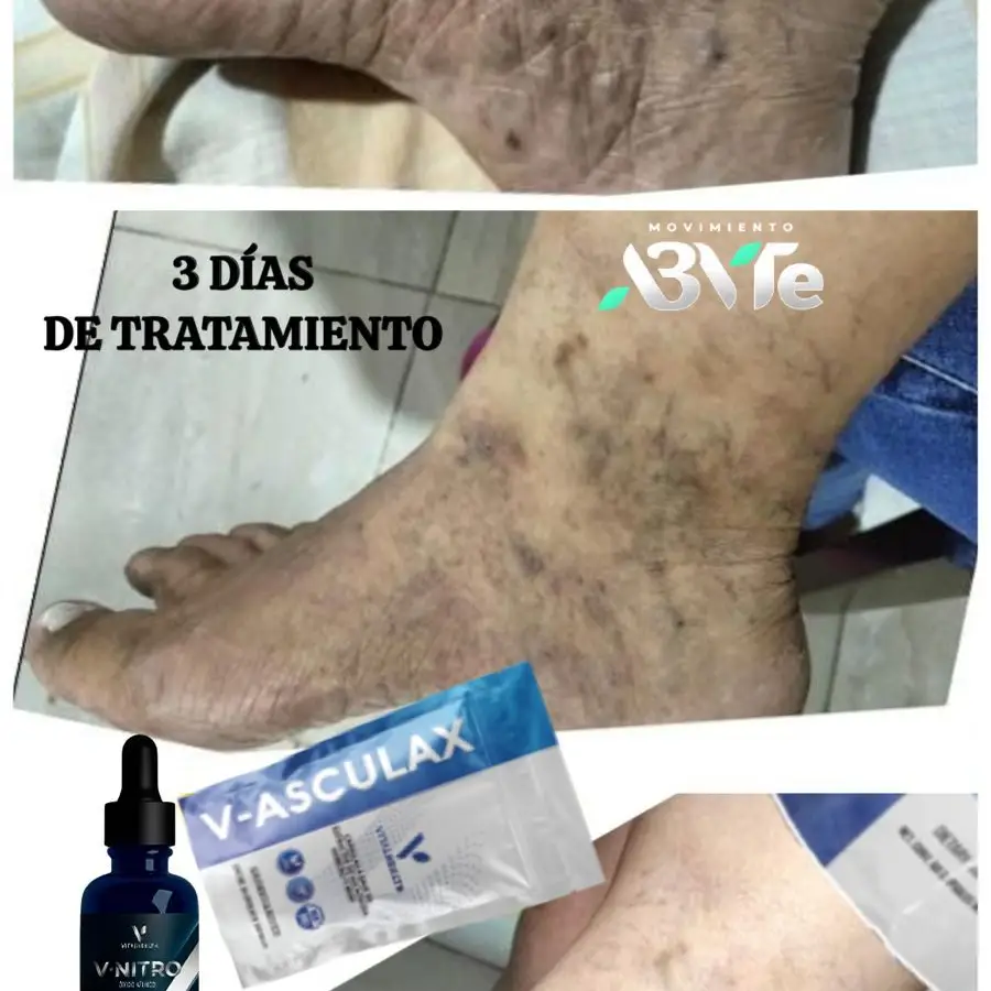 V-ASCULAX Vital Health | Circulación y Piernas Ligeras's photo #7
