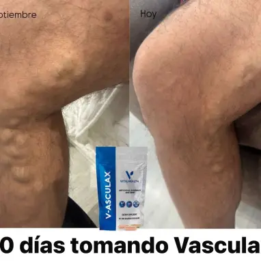 V-ASCULAX Vital Health | Circulación y Piernas Ligeras's photo #1