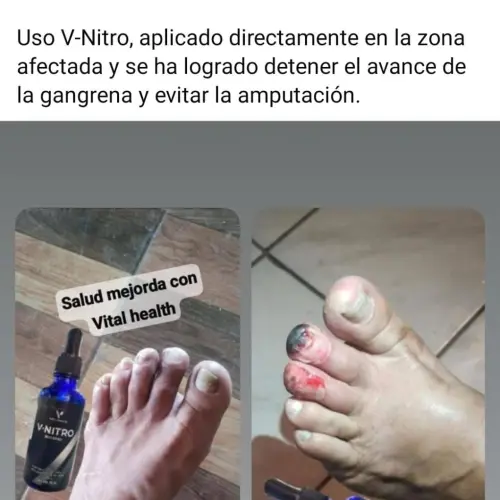 V-Nitro Vital Health|Potencia y Óxido Nítrico Natural's photo #6