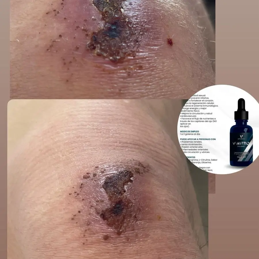 V-Nitro Vital Health|Potencia y Óxido Nítrico Natural's photo #5