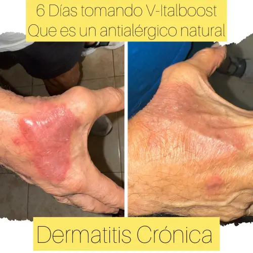 VITALBOOST | Defensas, Rinitis, Asma y Alergias's photo #4